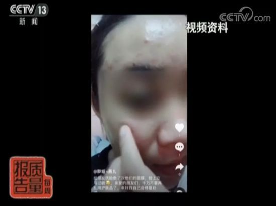 leyu乐鱼美容变毁容！这款面膜菌落超标7200倍！这些面膜含激素(图2)