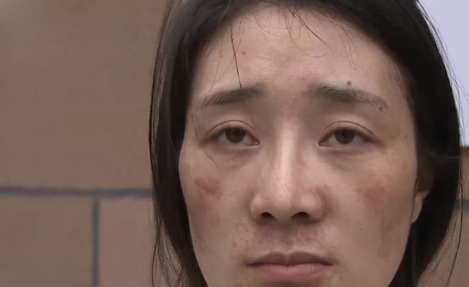 乐鱼体育花6800买面膜粉使用后脸上都是褐色斑点女子：两个月不敢出门(图1)