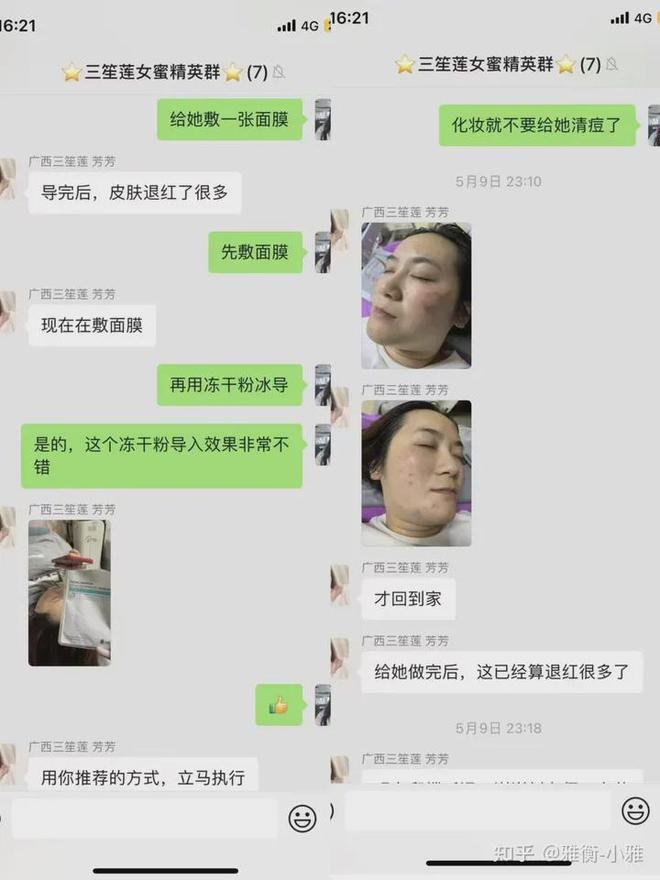 乐鱼体育衡肽臻颜在家和在美容院使用有什么区别？(图1)